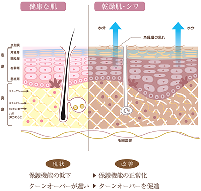 健康な肌と乾燥肌・シワの比較
