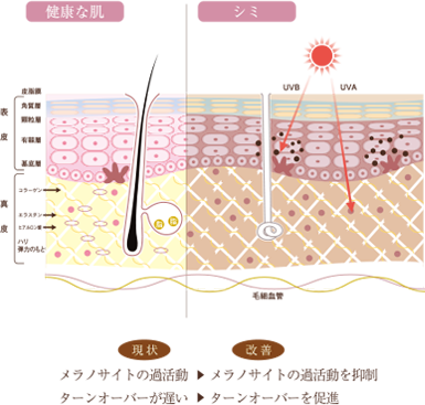健康な肌とシミの比較